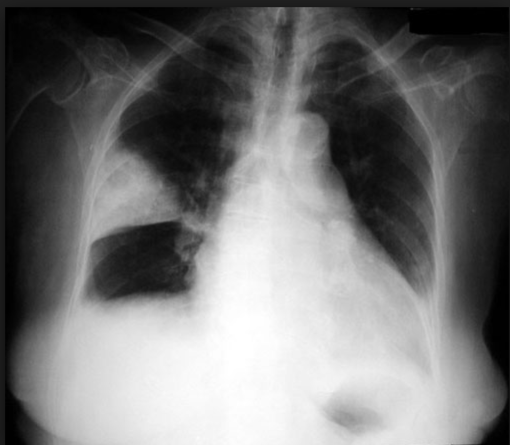 Image for question 268