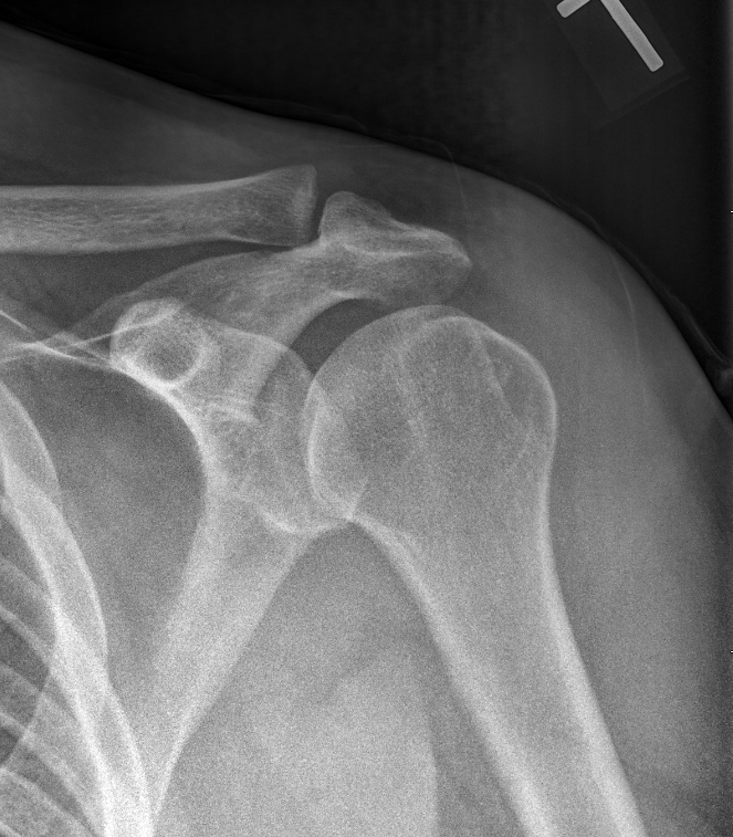 Image for question 701