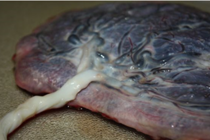 Image for question 238