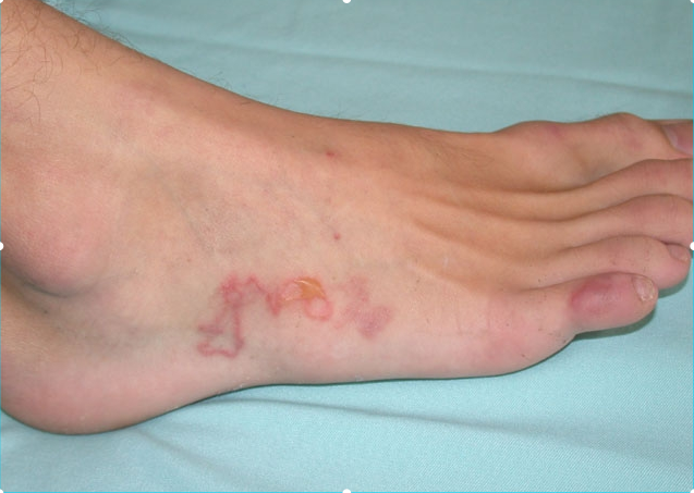 Image for question 1295