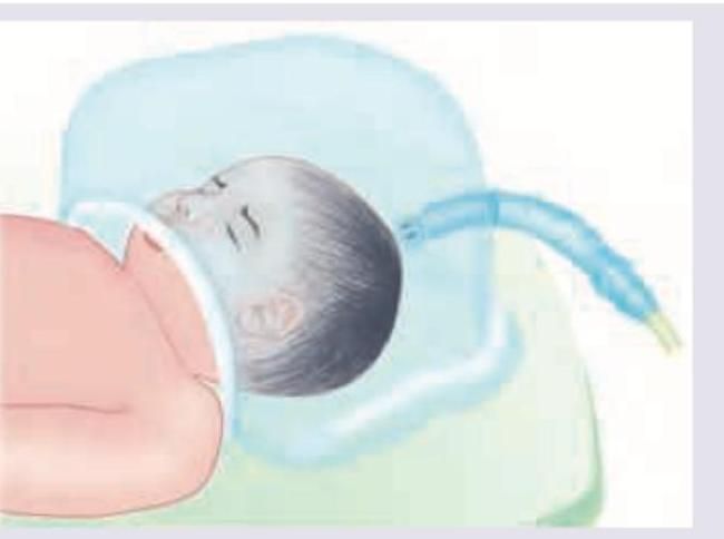 Image for question 291