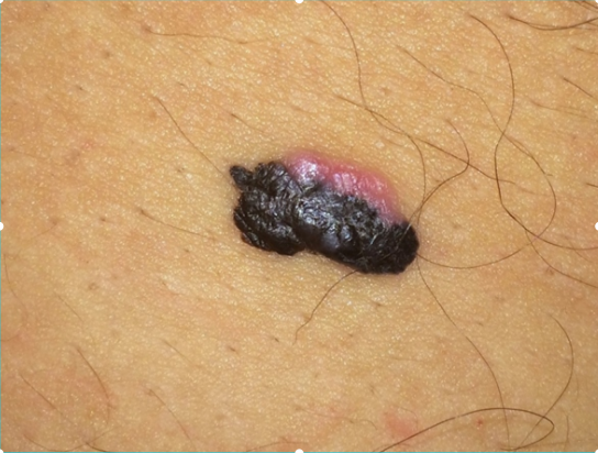 Image for question 270