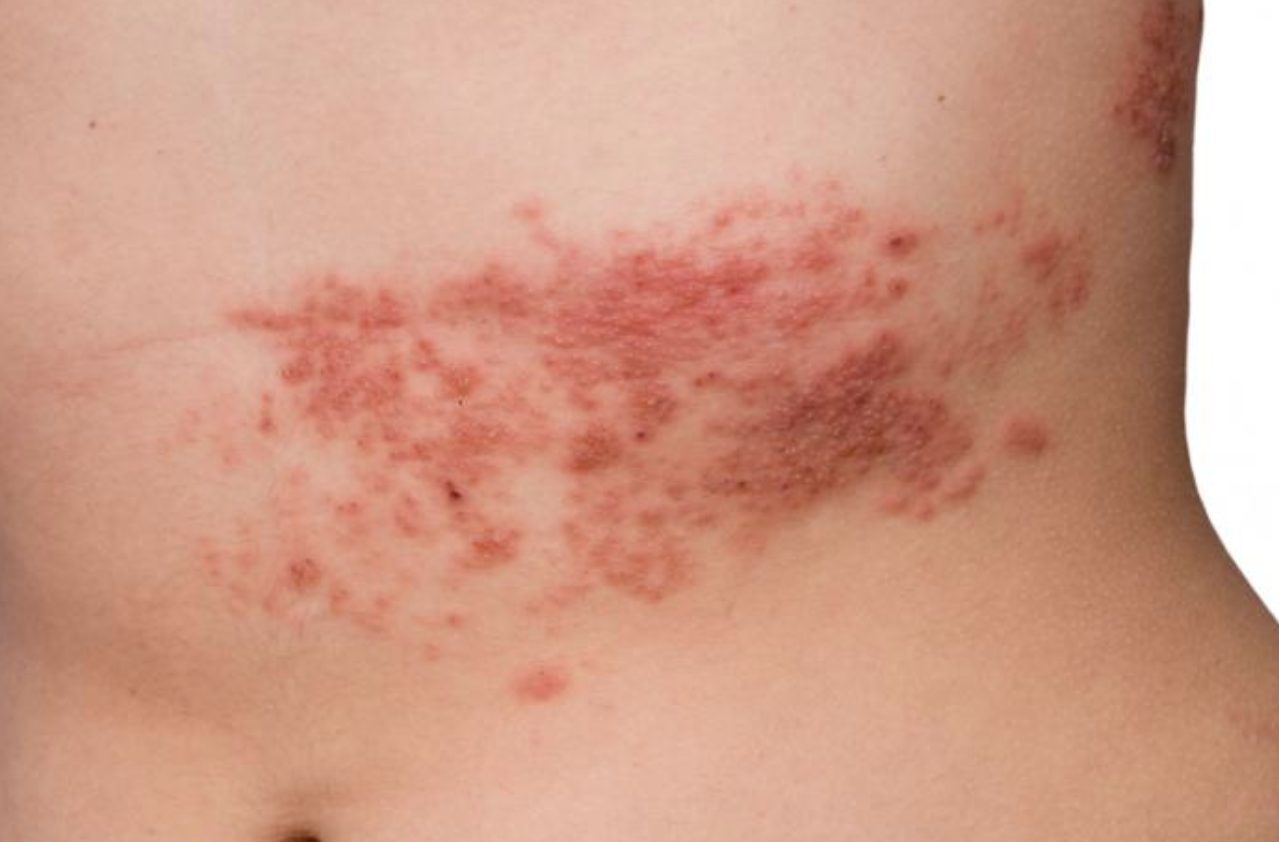 Image for question 977