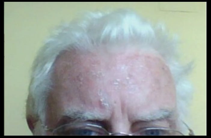 Image for question 122