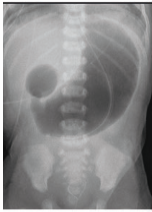 Image for question 92