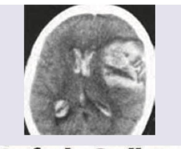 Image for question 772