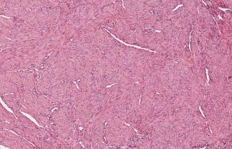 Image for question 90