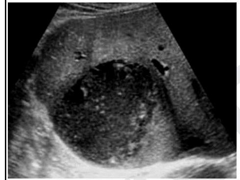 Image for question 5