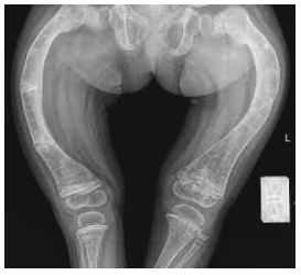 Image for question 142