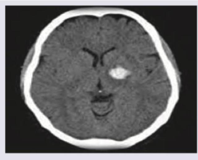 Image for question 636