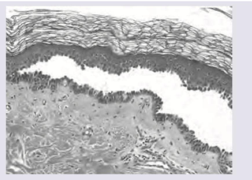 Image for question 182