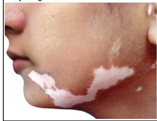 Image for question 315