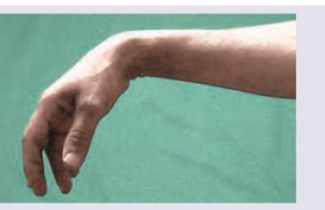 Image for question 560