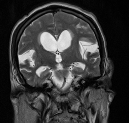 Image for question 1