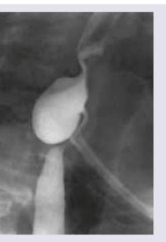 Image for question 316