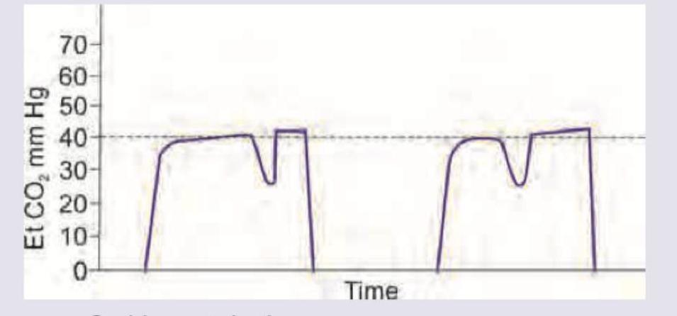 Image for question 193