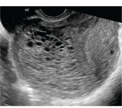 Image for question 70