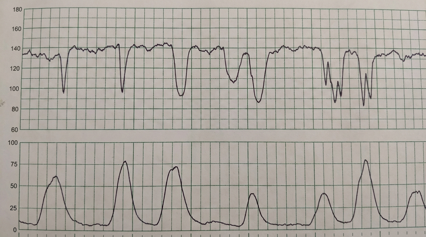 Image for question 167