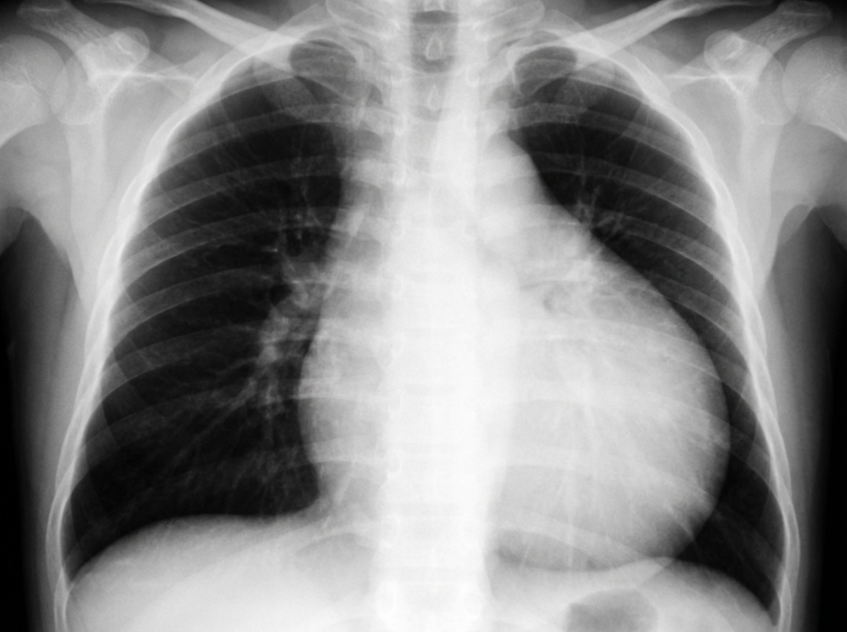 Image for question 731