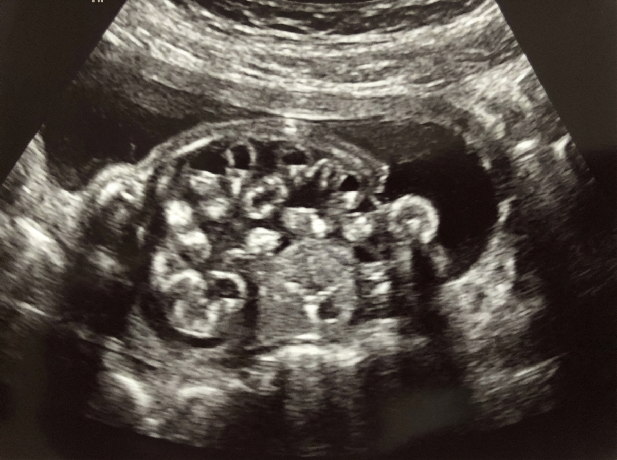 Image for question 7