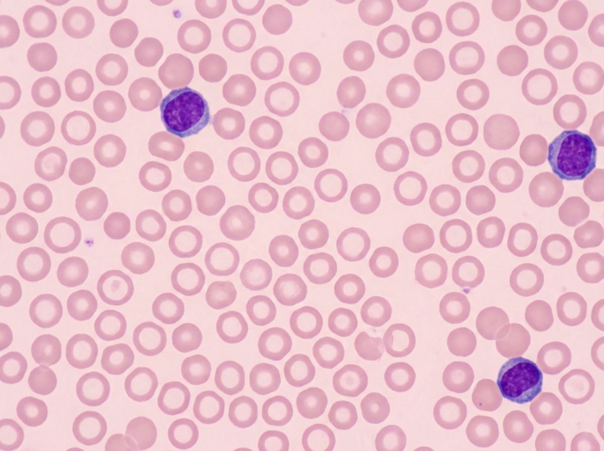 Image for question 212