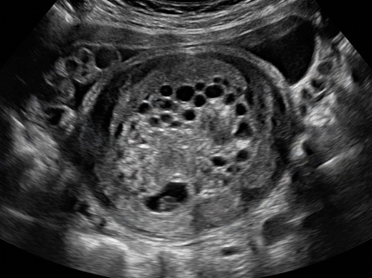 Image for question 14