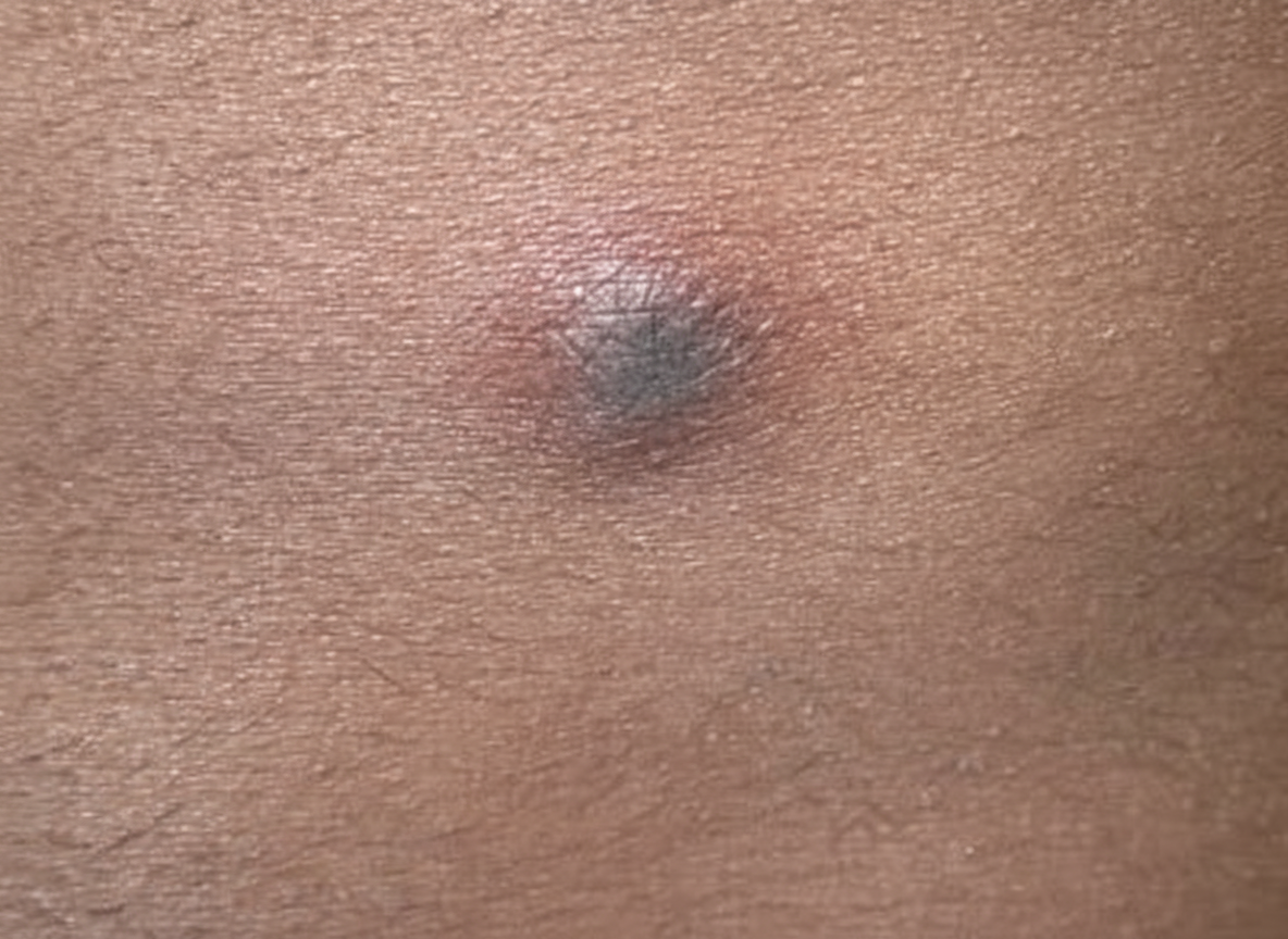 Image for question 90