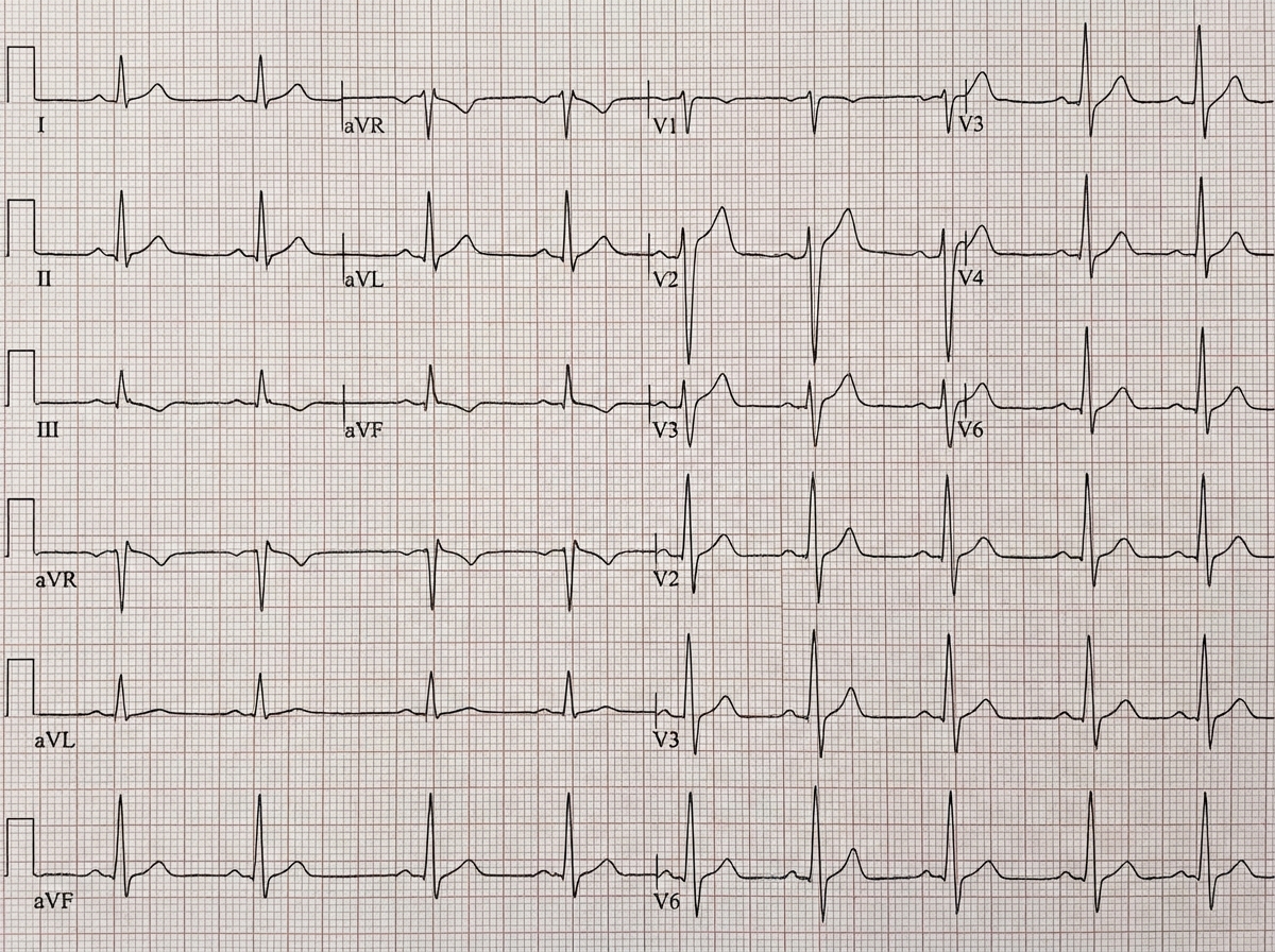 Image for question 2