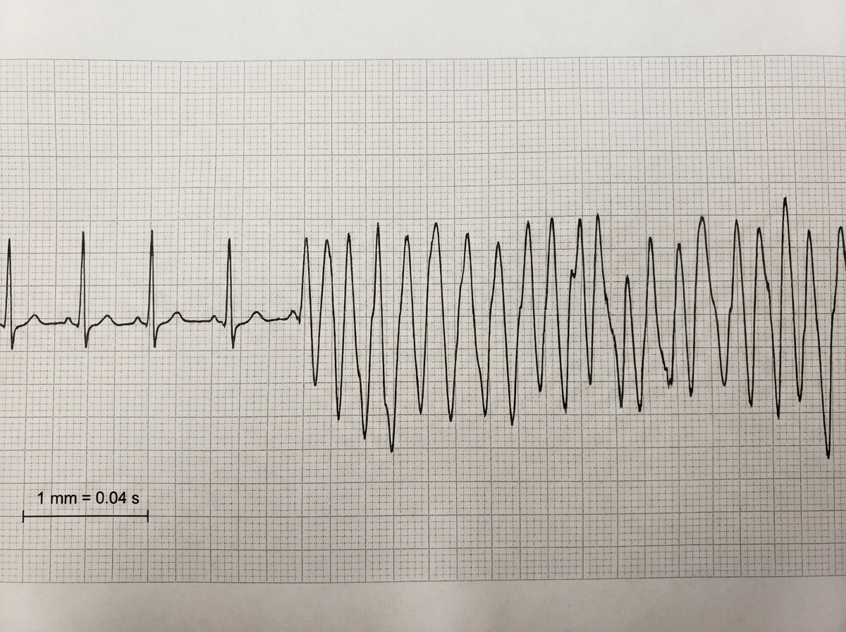 Image for question 698