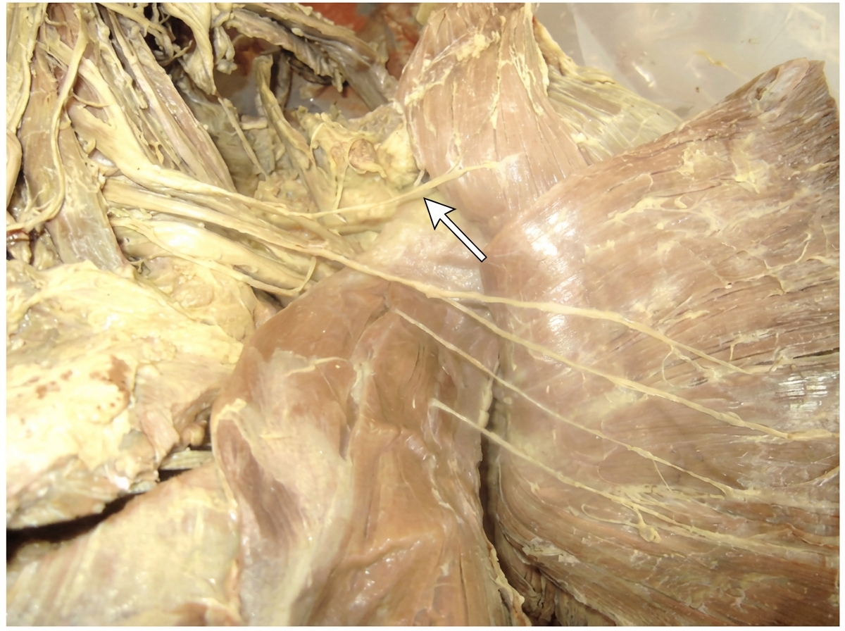 Image for question 1