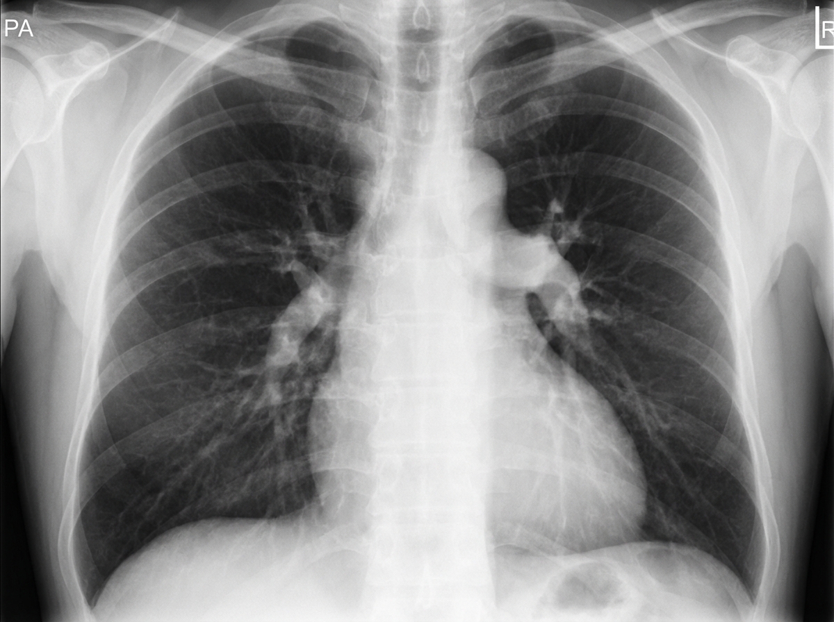 Image for question 696