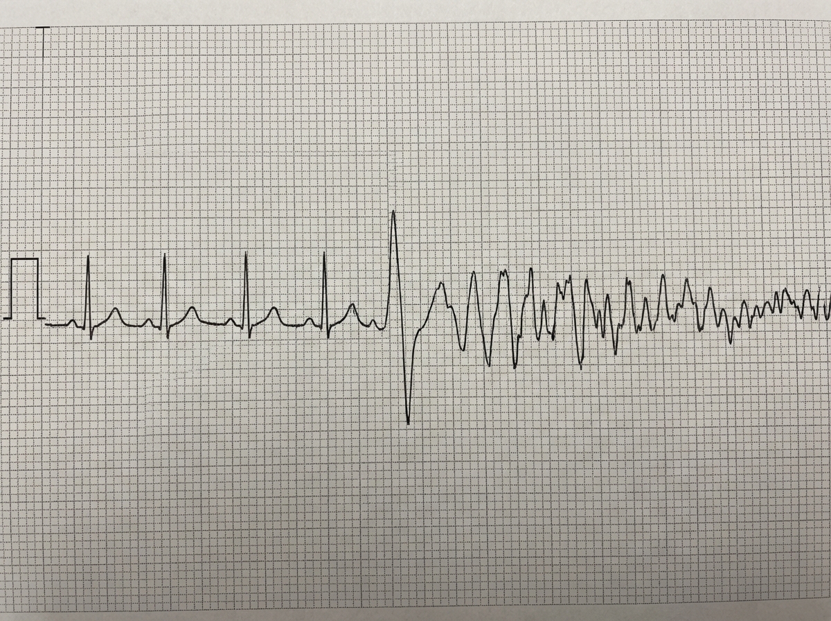 Image for question 419