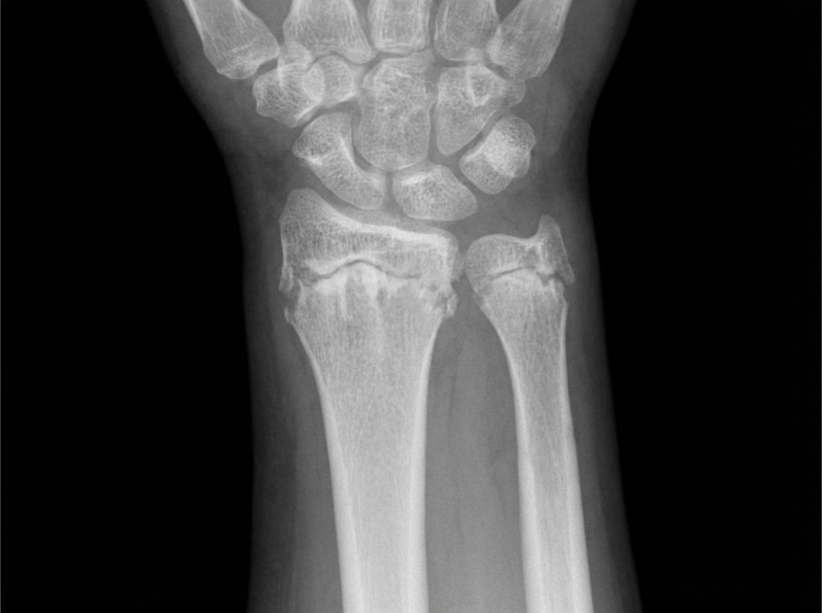 Image for question 98