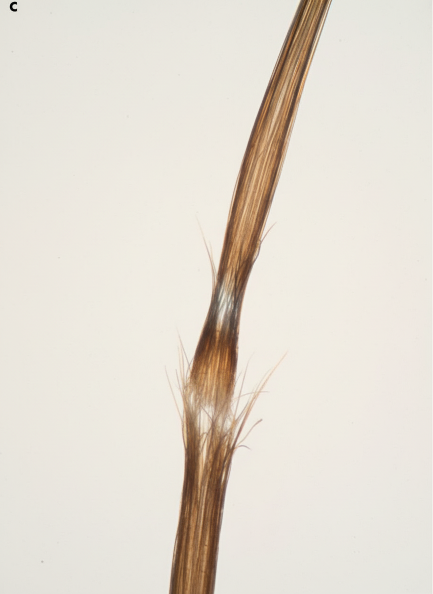 Image for question 223