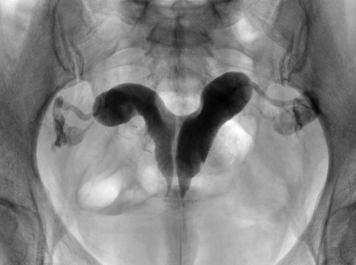 Image for question 301