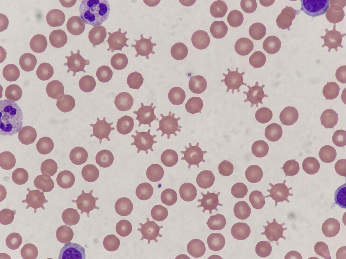 Image for question 314