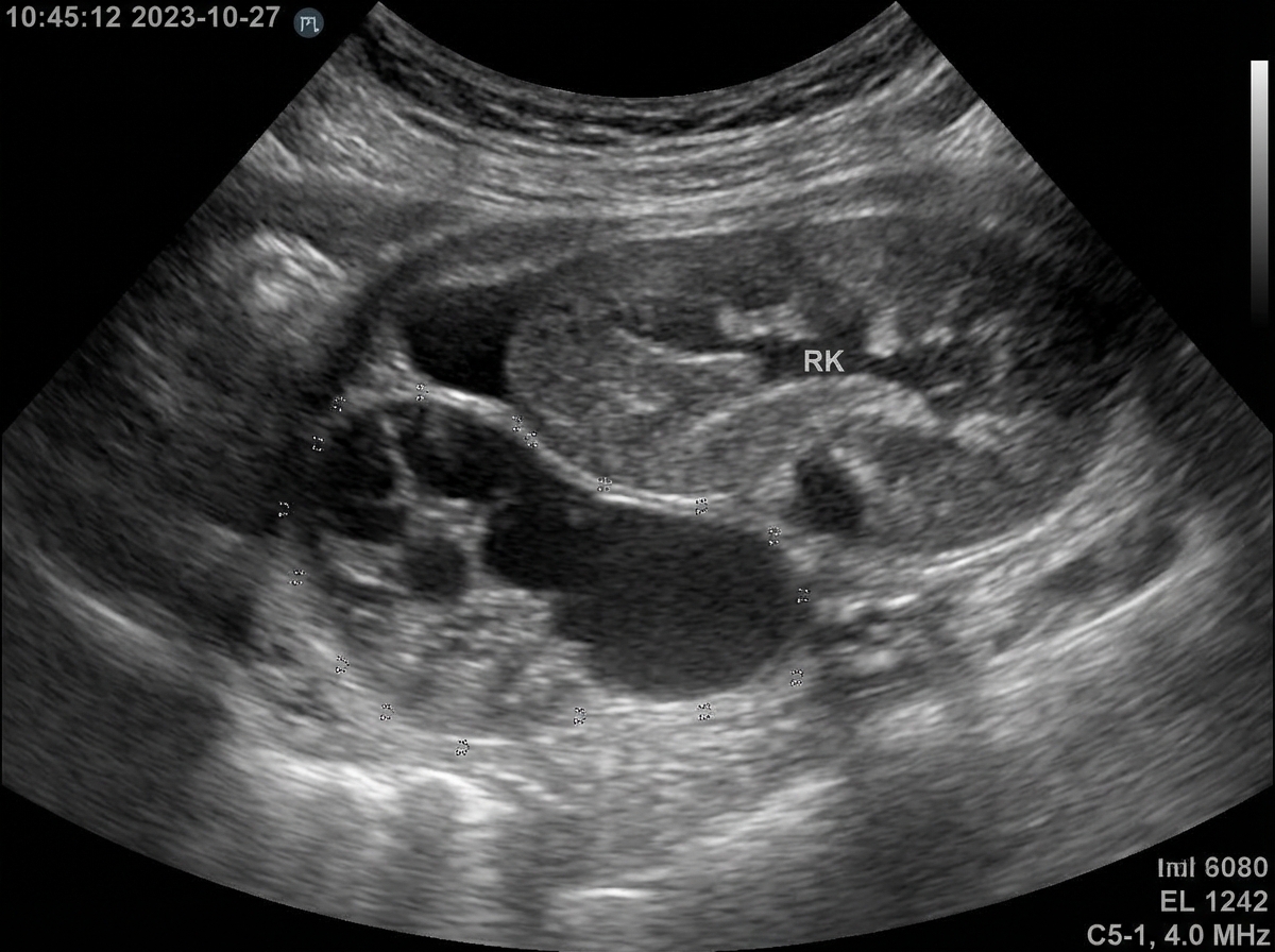 Image for question 325