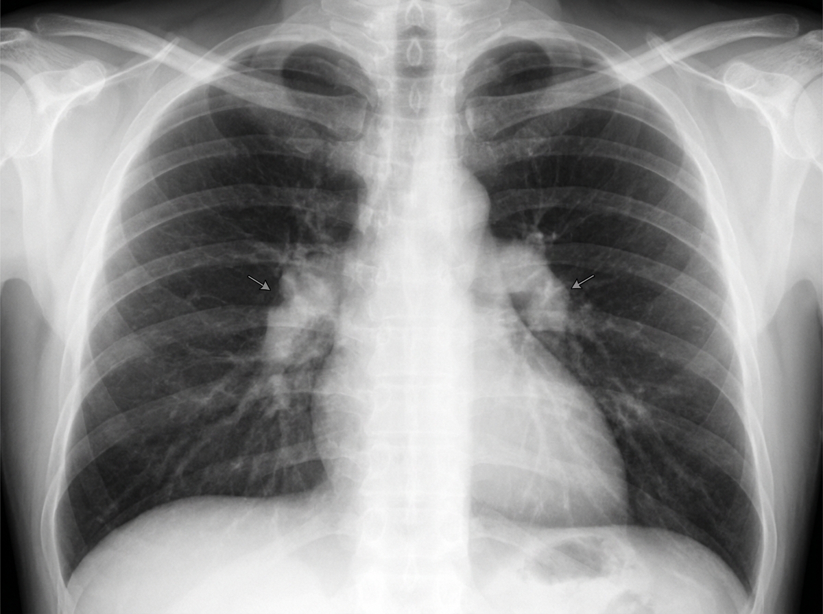 Image for question 1041