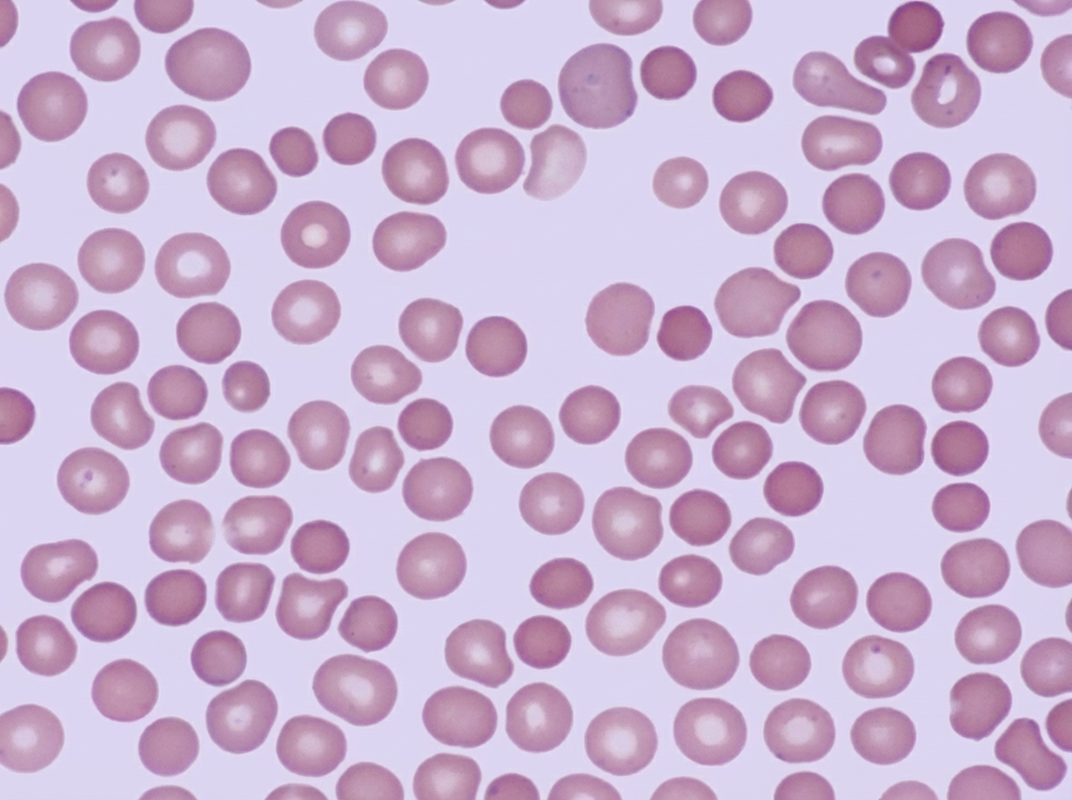 Image for question 94