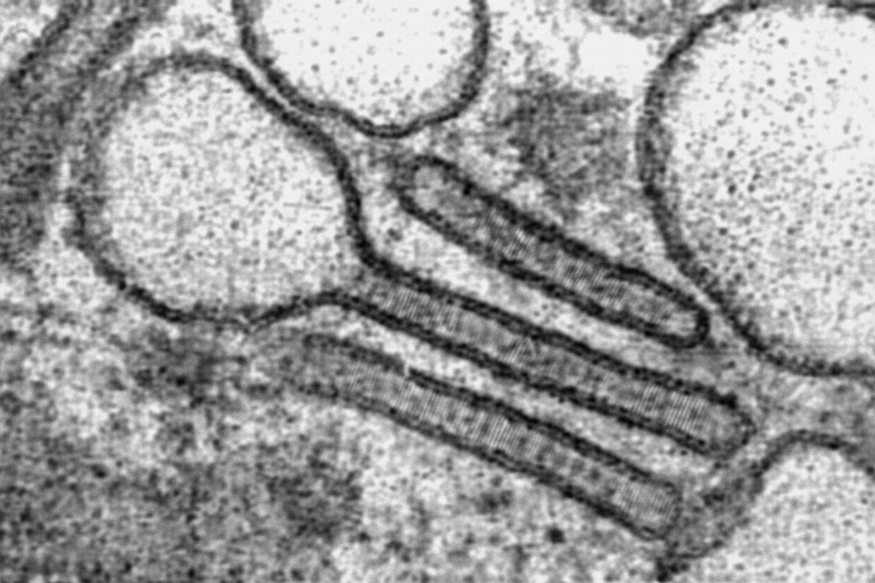 Image for question 70