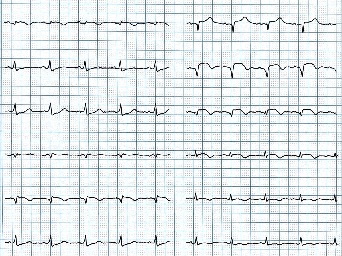Image for question 33