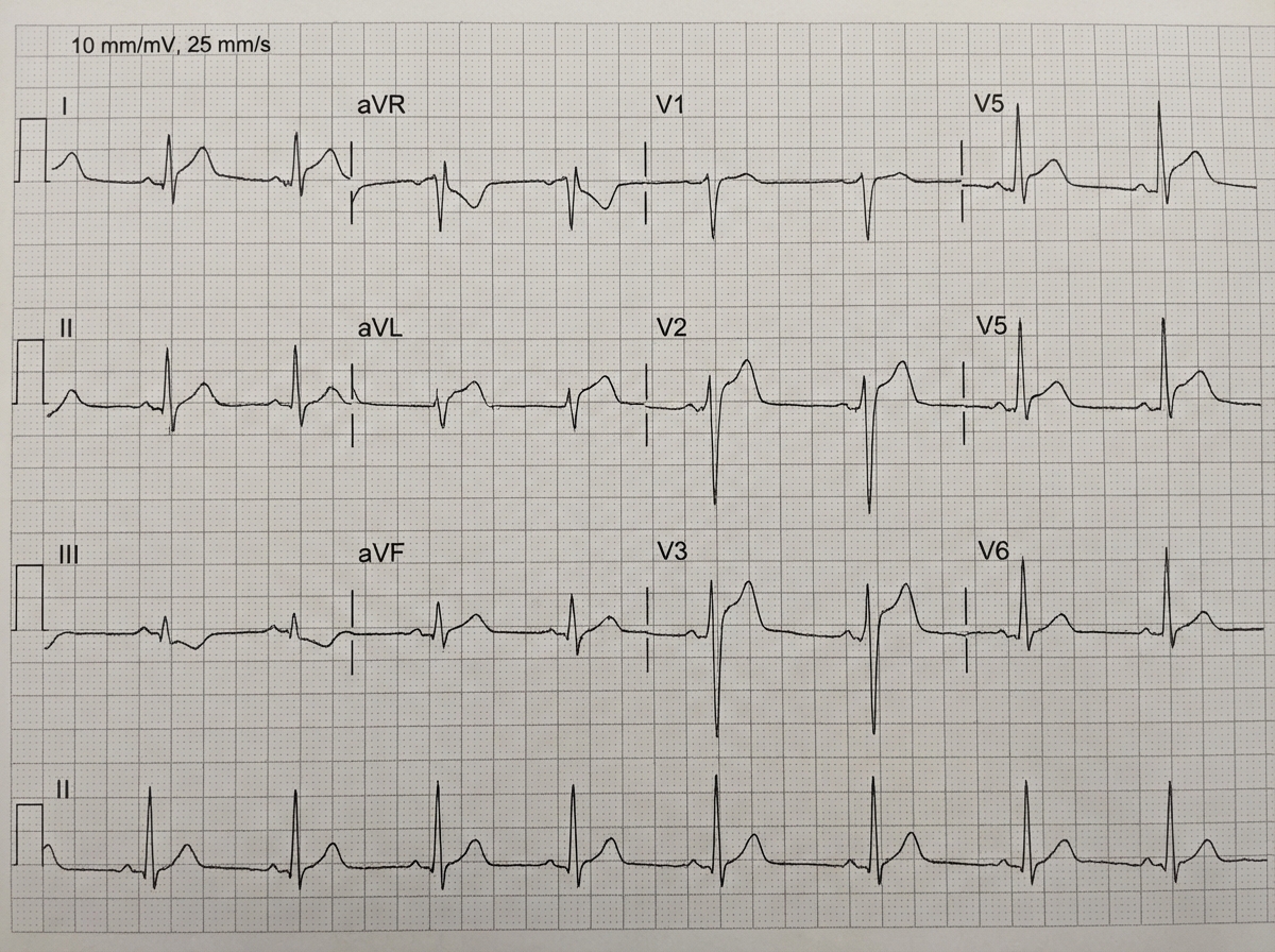 Image for question 637