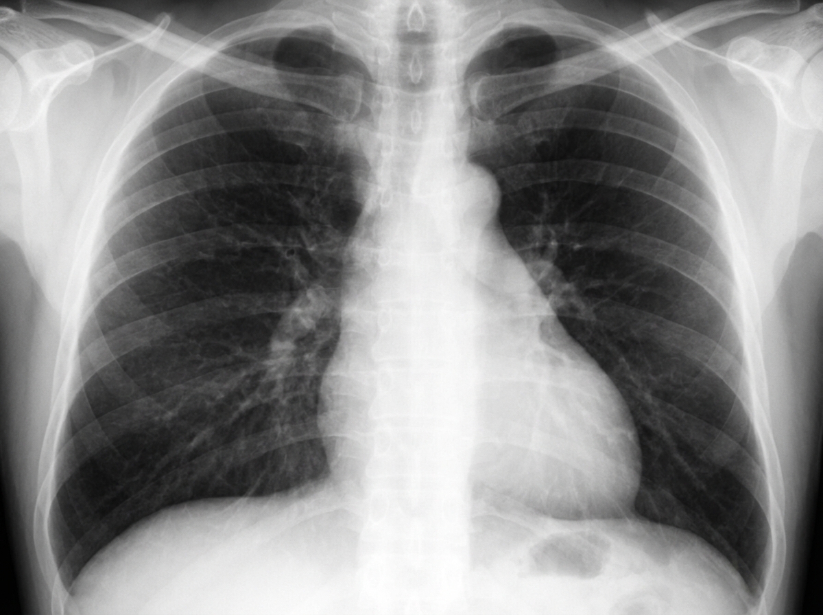 Image for question 510