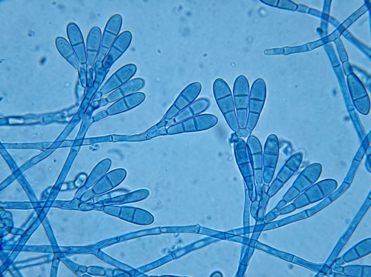 Image for question 191