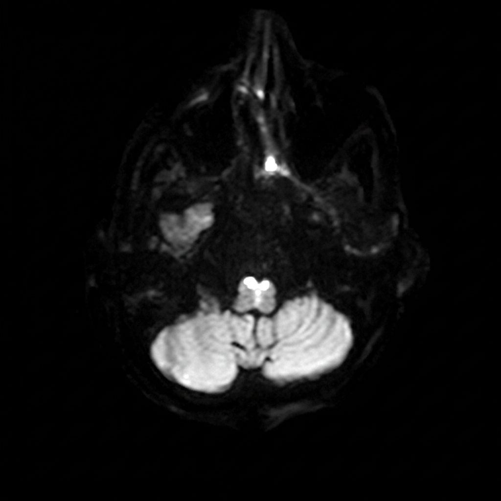 Image for question 245