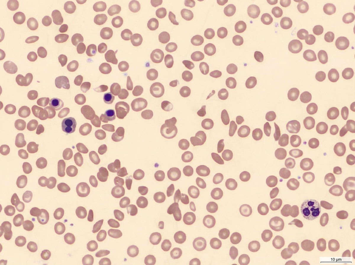 Image for question 741