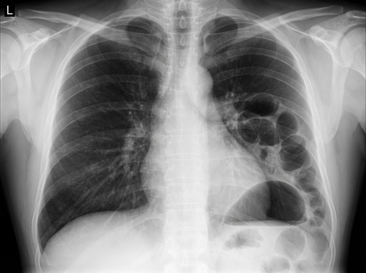 Image for question 1