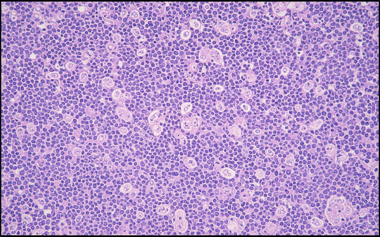 Image for question 1122