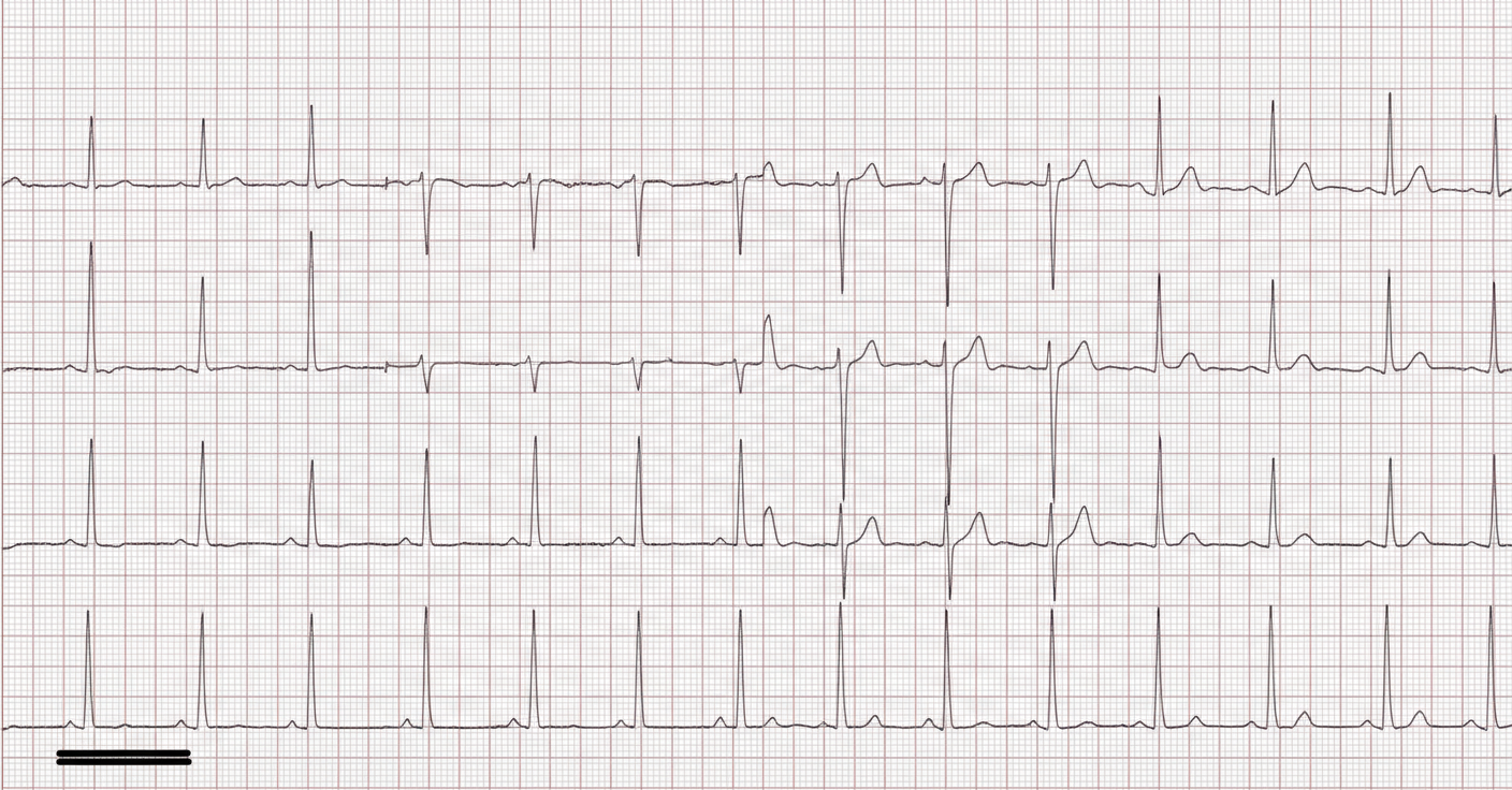 Image for question 378