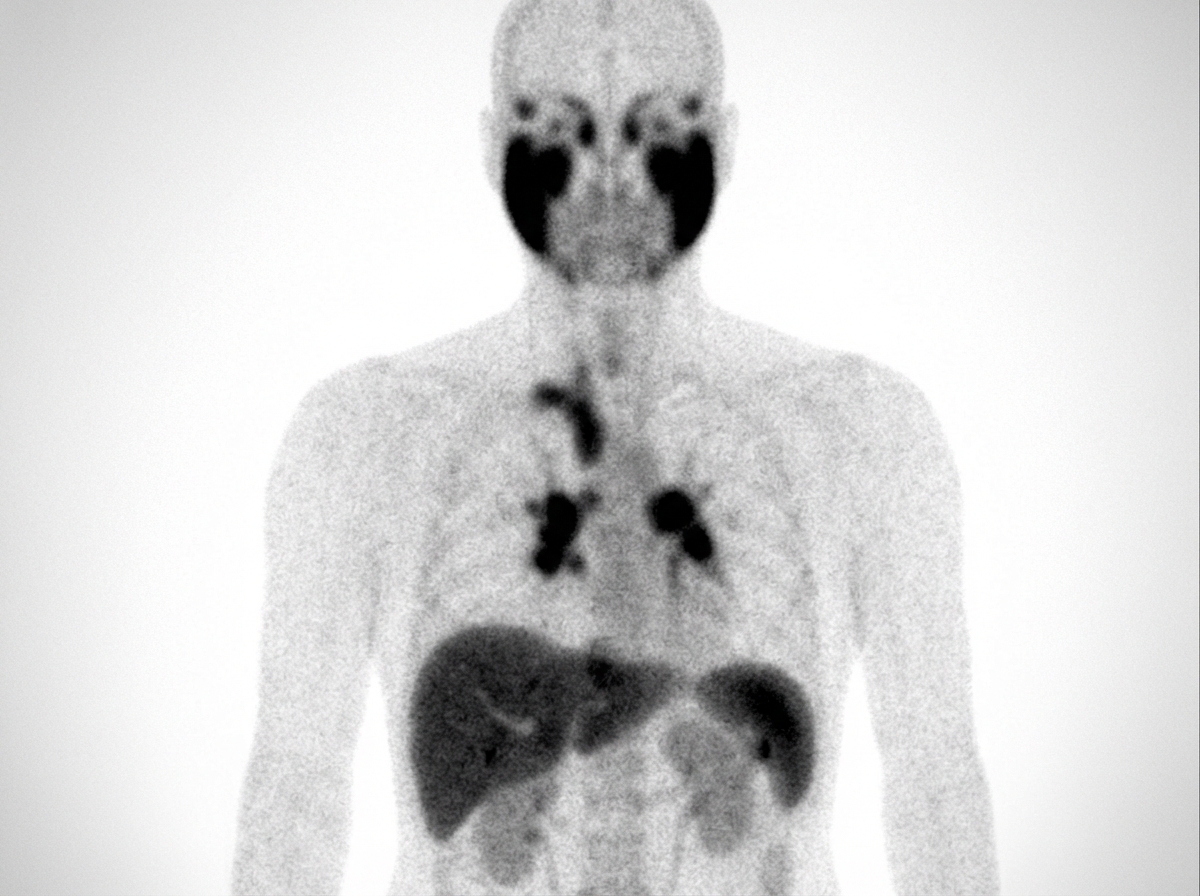 Image for question 116